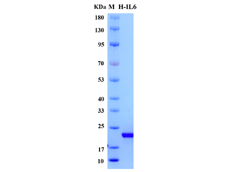 Human IL-6 Protein - SDS-PAGE电泳图