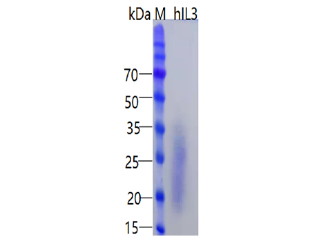 Human IL-3 Protein, His tag (Animal-Free) - SDS-PAGE电泳图
