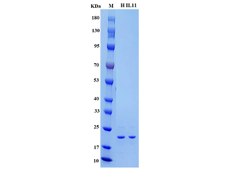Human IL-11 Protein - SDS-PAGE电泳图