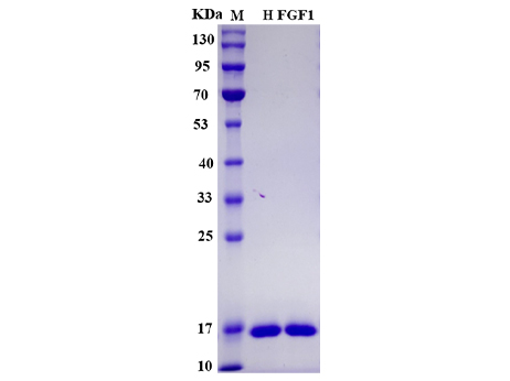 Human FGF1/FGF acidic Protein - SDS-PAGE电泳图