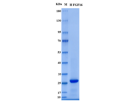 Human FGF16 Protein - SDS-PAGE电泳图