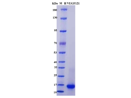 Human VEGF121 Protein - SDS-PAGE电泳图