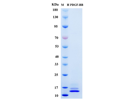Human PDGF-BB Protein - SDS-PAGE电泳图