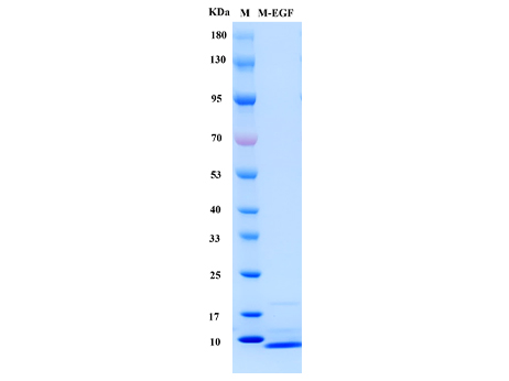 Mouse EGF Protein - SDS-PAGE电泳图