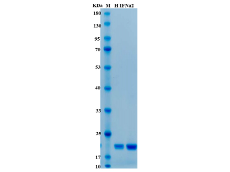 Human IFN-α2a Protein - SDS-PAGE电泳图