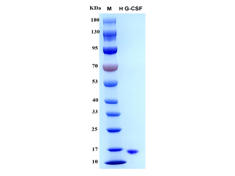 Human G-CSF Protein - SDS-PAGE电泳图