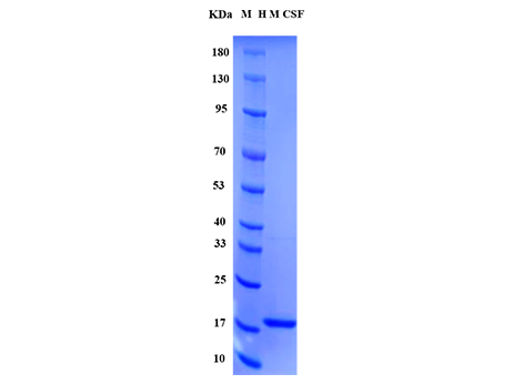 Human M-CSF Protein - SDS-PAGE电泳图