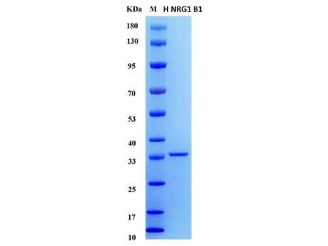 Human NRG1 Beta1 Protein - SDS-PAGE电泳图