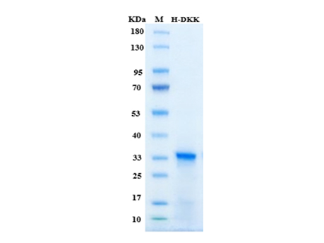 Human DKK-1 Protein - SDS-PAGE电泳图