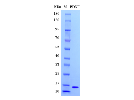 Human/Mouse/Rat BDNF protein (Animal-Free) - SDS-PAGE电泳图