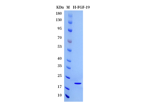 Human FGF-19 protein - SDS-PAGE电泳图