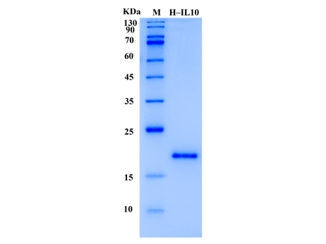 Human IL-10 Protein (Animal-Free) - SDS-PAGE电泳图