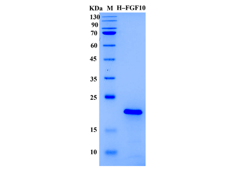 Human FGF-10 Protein (Animal-Free) - SDS-PAGE电泳图
