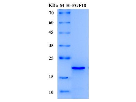 Human FGF-18 Protein (Animal-Free) - SDS-PAGE电泳图