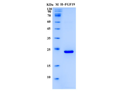 Human FGF-19 Protein (Animal-Free) - SDS-PAGE电泳图