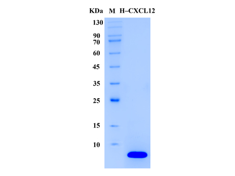 Human CXCL12 Protein (Animal-Free) - SDS-PAGE电泳图
