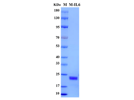 Mouse IL-6 Protein - SDS-PAGE电泳图