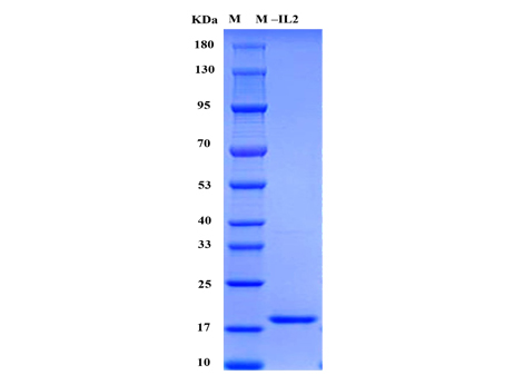 Mouse IL-2 Protein - SDS-PAGE电泳图