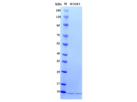 Mouse IGF1 Protein, His tag - SDS-PAGE电泳图