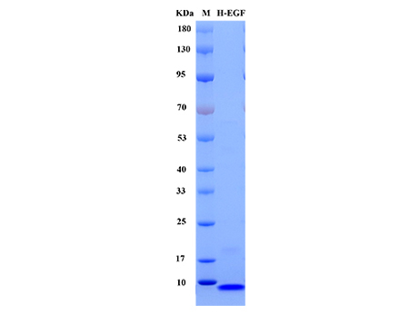 Human  EGF Protein - SDS-PAGE电泳图