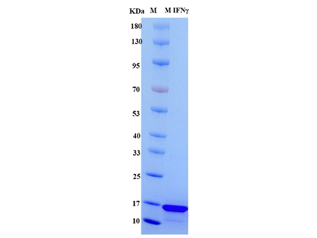 Mouse IFN-γ Protein, His Tag - SDS-PAGE电泳图