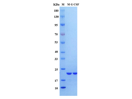 Mouse G-CSF Protein,His tag - SDS-PAGE电泳图