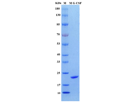 Mouse G-CSF Protein - SDS-PAGE电泳图