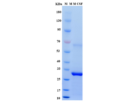 Mouse M-CSF Protein - SDS-PAGE电泳图