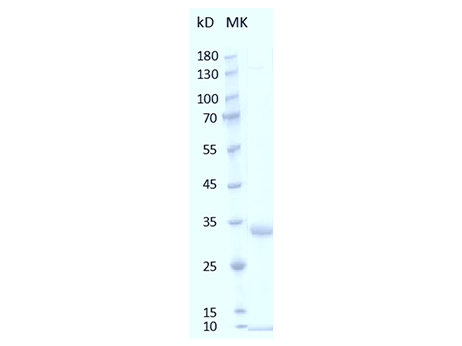 Mouse M-CSF Protein, His tag - SDS-PAGE电泳图
