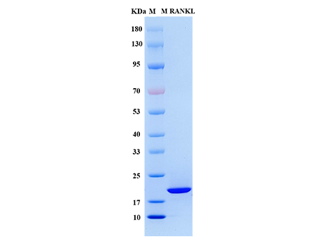 Mouse RANKL Protein - SDS-PAGE电泳图