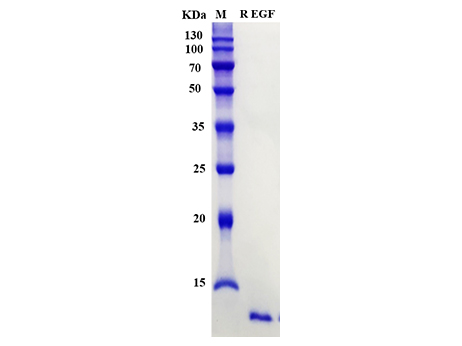 Rat EGF Protein - SDS-PAGE电泳图