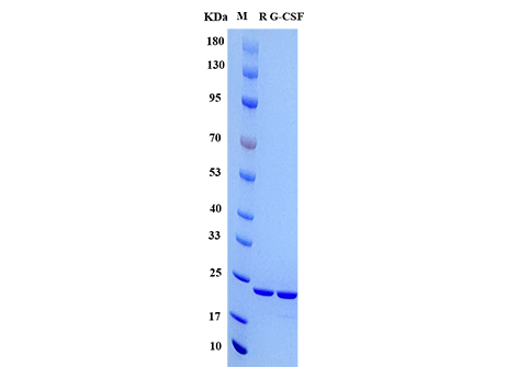 Rat G-CSF Protein, His tag - SDS-PAGE电泳图