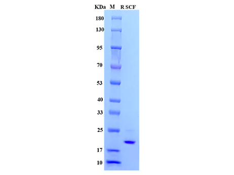 Rat SCF Protein,His tag - SDS-PAGE电泳图